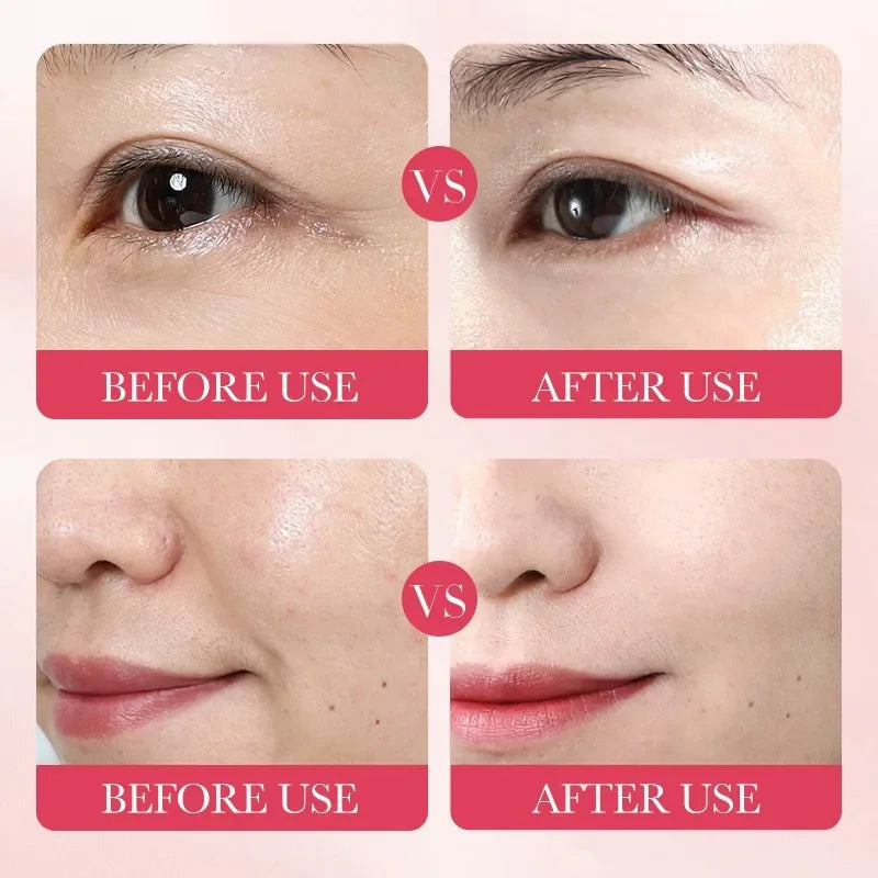5/10 PCS Korean Snail Mucin Sheet Mask Hydrating Repair Brightening Anti-Aging Wrinkle Moisturizing Gel Face Mask for All Skin