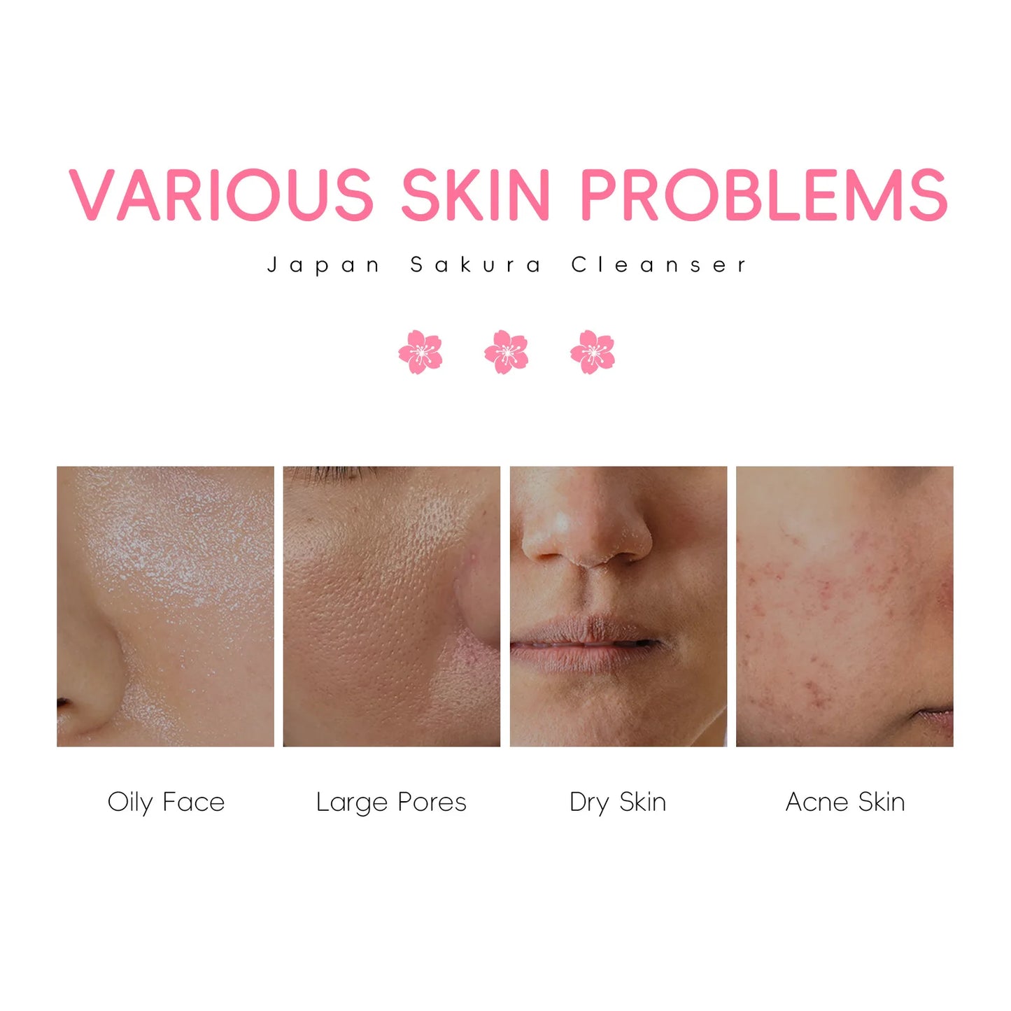 LAIKOU Facial Cleanser Foam Face Wash Remove Blackhead Moisturizing Shrink Pores Deep Cleaning Oil Control Skin Care 50g